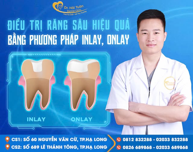 Điều trị sâu răng hiệu quả bằng phương pháp INPAY/ONLAY