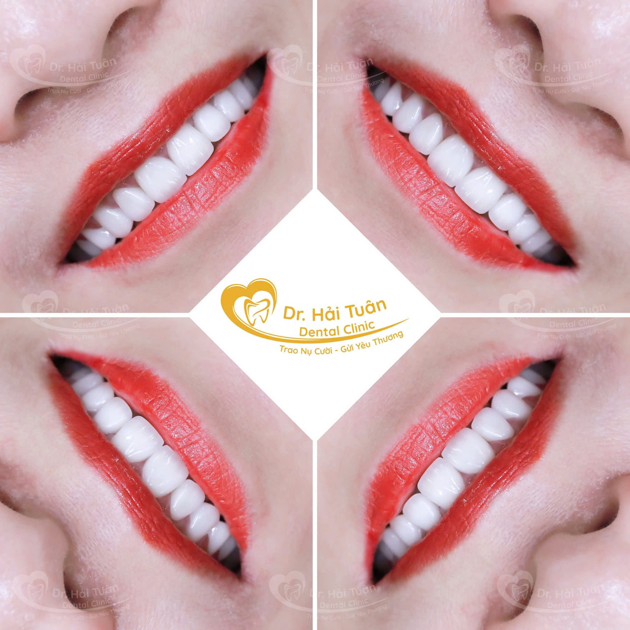 Nụ cười không chỉ là vẻ đẹp mà còn là sức khoẻ